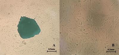 Therapeutic Effects of 17β-Estradiol on Pelvic Organ Prolapse by Inhibiting Mfn2 Expression: An In Vitro Study